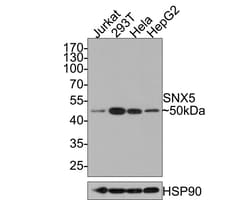 Invitrogen SNX5 Recombinant Rabbit Monoclonal Antibody (JE64-96) 100 &mu;L;