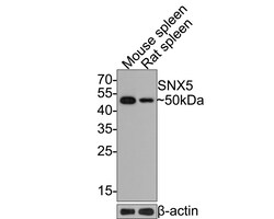 Invitrogen SNX5 Recombinant Rabbit Monoclonal Antibody (JE64-96) 100 &mu;L;