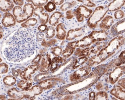 Invitrogen NDUFS2 Recombinant Rabbit Monoclonal Antibody (JE65-29) 100