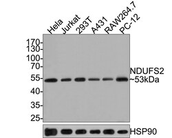 Invitrogen NDUFS2 Recombinant Rabbit Monoclonal Antibody (JE65-29) 100