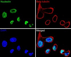 Invitrogen Nucleolin Recombinant Rabbit Monoclonal Antibody (JE65-71) 100