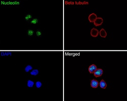 Invitrogen Nucleolin Recombinant Rabbit Monoclonal Antibody (JE65-71) 100