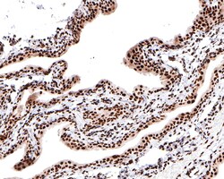 Invitrogen Nucleolin Recombinant Rabbit Monoclonal Antibody (JE65-71) 100