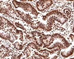 Invitrogen Nucleolin Recombinant Rabbit Monoclonal Antibody (JE65-71) 100