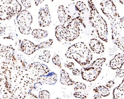 Invitrogen Nucleolin Recombinant Rabbit Monoclonal Antibody (JE65-71) 100