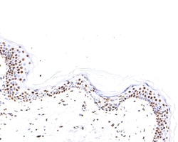 Invitrogen Nucleolin Recombinant Rabbit Monoclonal Antibody (JE65-71) 100