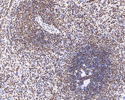 Invitrogen Nucleolin Recombinant Rabbit Monoclonal Antibody (JE65-71) 100