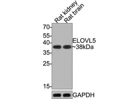 Invitrogen ELOVL5 Recombinant Rabbit Monoclonal Antibody (JE65-70) 100