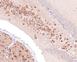 Invitrogen PREPL Recombinant Rabbit Monoclonal Antibody (JE65-64) 100 &mu;L;