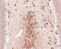 Invitrogen PREPL Recombinant Rabbit Monoclonal Antibody (JE65-64) 100 &mu;L;