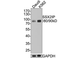 Invitrogen SSX2IP Recombinant Rabbit Monoclonal Antibody (JE65-50) 100