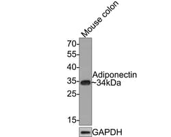 Invitrogen Adiponectin Recombinant Rabbit Monoclonal Antibody (JE65-49) 100 &mu;L | Buy Online | Invitrogen&trade; | Fisher Scientific