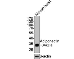 Invitrogen Adiponectin Recombinant Rabbit Monoclonal Antibody (JE65-49) 100 &mu;L | Buy Online | Invitrogen&trade; | Fisher Scientific