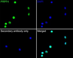 Invitrogen PRPF4 Recombinant Rabbit Monoclonal Antibody (JE65-37) 100 &mu;L;