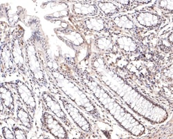 Invitrogen PRPF4 Recombinant Rabbit Monoclonal Antibody (JE65-37) 100 &mu;L;
