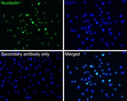 Invitrogen CRCP Recombinant Rabbit Monoclonal Antibody (JE65-42) 100 &mu;L | Buy Online | Invitrogen&trade; | Fisher Scientific