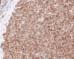 Invitrogen CRCP Recombinant Rabbit Monoclonal Antibody (JE65-42) 100 &mu;L | Buy Online | Invitrogen&trade; | Fisher Scientific