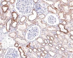 Invitrogen TSFM Recombinant Rabbit Monoclonal Antibody (JE64-29) 100 &mu;L;