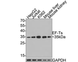 Invitrogen TSFM Recombinant Rabbit Monoclonal Antibody (JE64-29) 100 &mu;L;