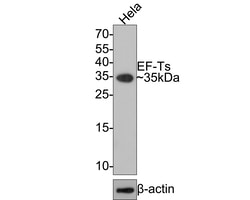 Invitrogen TSFM Recombinant Rabbit Monoclonal Antibody (JE64-29) 100 &mu;L;