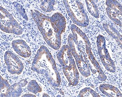 Invitrogen ACADS Recombinant Rabbit Monoclonal Antibody (JE64-13) 100 &mu;L;