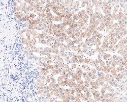 Invitrogen ACADS Recombinant Rabbit Monoclonal Antibody (JE64-13) 100 &mu;L;