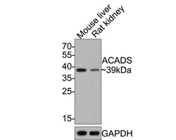 Invitrogen ACADS Recombinant Rabbit Monoclonal Antibody (JE64-13) 100 &mu;L;