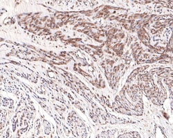 Invitrogen UFD1L Recombinant Rabbit Monoclonal Antibody (JE64-80) 100 &mu;L;