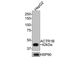 Invitrogen ACTR1B Recombinant Rabbit Monoclonal Antibody (JE65-44) 100