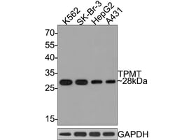 Invitrogen TPMT Recombinant Rabbit Monoclonal Antibody (JE64-09) 100 &mu;L | Buy Online | Invitrogen&trade; | Fisher Scientific
