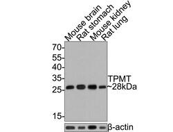 Invitrogen TPMT Recombinant Rabbit Monoclonal Antibody (JE64-09) 100 &mu;L | Buy Online | Invitrogen&trade; | Fisher Scientific