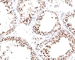 Invitrogen PPM1G Recombinant Rabbit Monoclonal Antibody (JE64-91) 100 &mu;L;