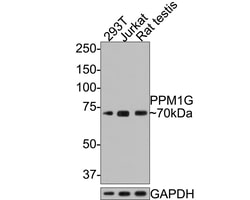 Invitrogen PPM1G Recombinant Rabbit Monoclonal Antibody (JE64-91) 100 &mu;L;