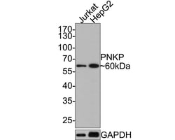 Invitrogen PNK Recombinant Rabbit Monoclonal Antibody (JE64-21) 100 &mu;L | Buy Online | Invitrogen&trade; | Fisher Scientific