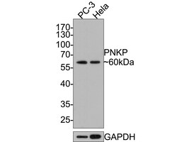 Invitrogen PNK Recombinant Rabbit Monoclonal Antibody (JE64-21) 100 &mu;L | Buy Online | Invitrogen&trade; | Fisher Scientific