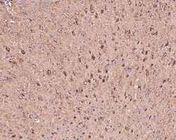 Invitrogen MDH2 Recombinant Rabbit Monoclonal Antibody (JE64-68) 100 &mu;L;