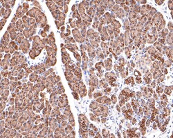 Invitrogen KCTD9 Recombinant Rabbit Monoclonal Antibody (JE64-67) 100 &mu;L | Buy Online | Invitrogen&trade; | Fisher Scientific