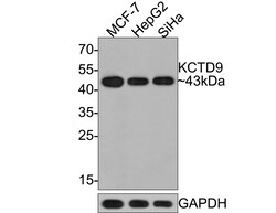 Invitrogen KCTD9 Recombinant Rabbit Monoclonal Antibody (JE64-67) 100 &mu;L | Buy Online | Invitrogen&trade; | Fisher Scientific