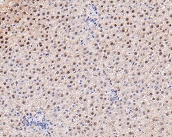 Invitrogen ADSS Recombinant Rabbit Monoclonal Antibody (JE64-42) 100 &mu;L;