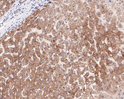 Invitrogen ITPK1 Recombinant Rabbit Monoclonal Antibody (JE64-35) 100 &mu;L;