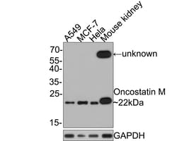 Invitrogen Oncostatin M Recombinant Rabbit Monoclonal Antibody (JE40-04) 100 &mu;L | Buy Online | Invitrogen&trade; | Fisher Scientific