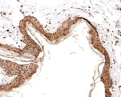 Invitrogen RSK2 Recombinant Rabbit Monoclonal Antibody (JE63-19) 100 &mu;L;