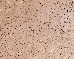 Invitrogen RSK2 Recombinant Rabbit Monoclonal Antibody (JE63-19) 100 &mu;L;