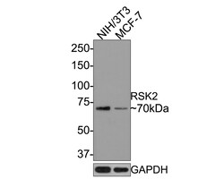 Invitrogen RSK2 Recombinant Rabbit Monoclonal Antibody (JE63-19) 100 &mu;L;