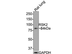 Invitrogen RSK2 Recombinant Rabbit Monoclonal Antibody (JE63-19) 100 &mu;L;