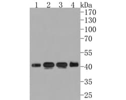 Invitrogen BCKDK Recombinant Rabbit Monoclonal Antibody (JE63-77) 100 &mu;L;