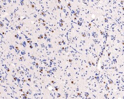 Invitrogen MEF2A/MEF2C Recombinant Rabbit Monoclonal Antibody (JE63-26)