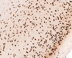 Invitrogen MEF2A/MEF2C Recombinant Rabbit Monoclonal Antibody (JE63-26)