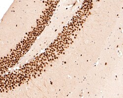 Invitrogen MEF2A/MEF2C Recombinant Rabbit Monoclonal Antibody (JE63-26)
