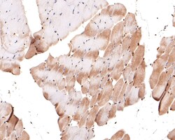 Invitrogen MEF2A/MEF2C Recombinant Rabbit Monoclonal Antibody (JE63-26)